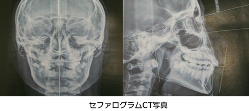 セファログラムで分析・診断