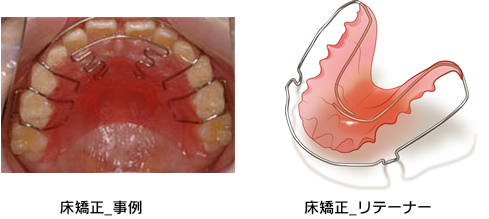 セファログラムで分析・診断