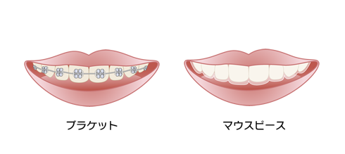 セファログラムで分析・診断